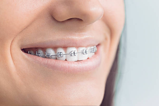 Best Dental Fillings (Composite and Amalgam)  in Canfield, OH